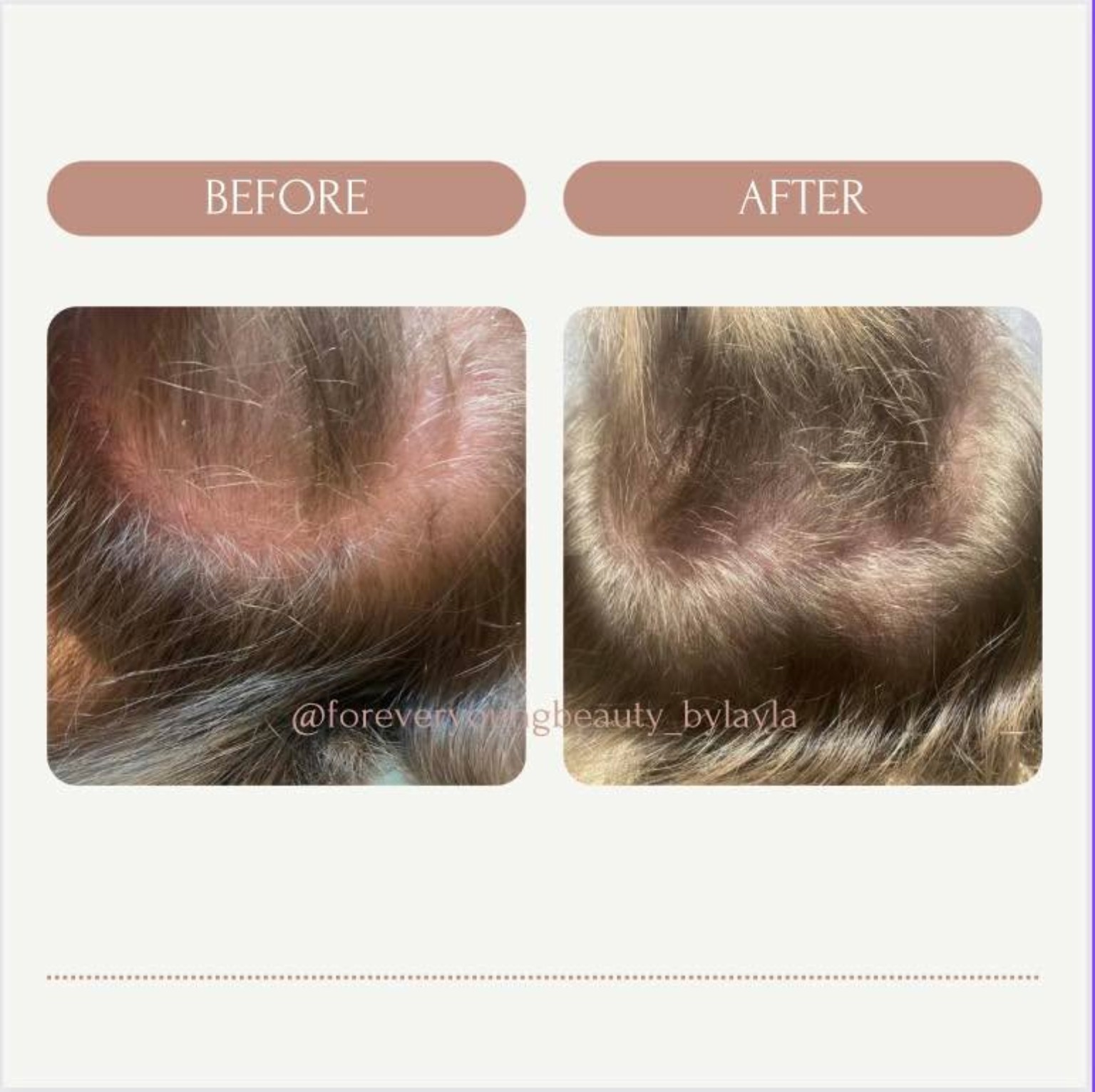 Scalp hair growth treatment before and after comparison